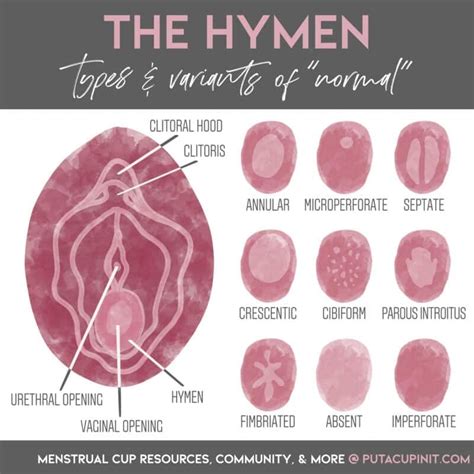 How to Know If Your Hymen is Broken (Torn): Symptoms